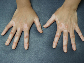 Hyppoimentationg - Application Senskin - capture écran