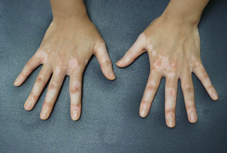 Hyppoimentationg - Application Senskin - capture écran